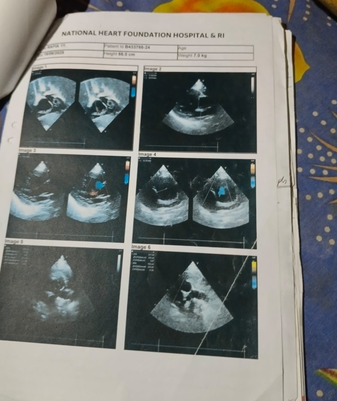 Page from Rafiya Sheikh's echocardiogram report showing six ultrasound images of her heart